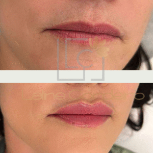 Luxury Lips - Close-up