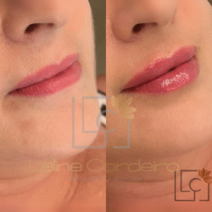 Luxury Lips Laline